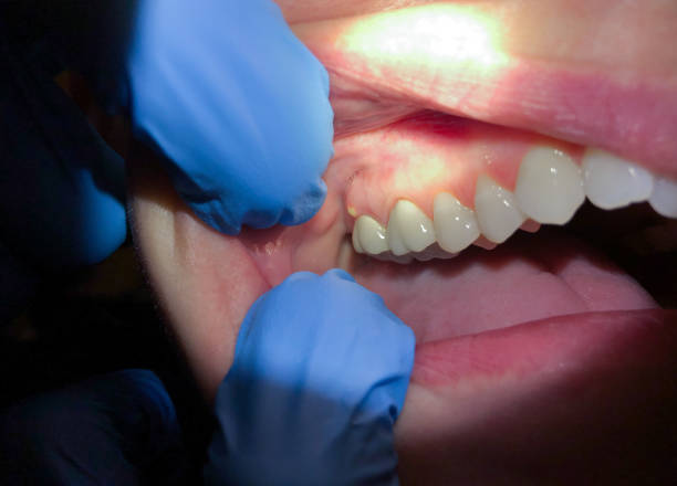 Professional Emergency Dentist in MA